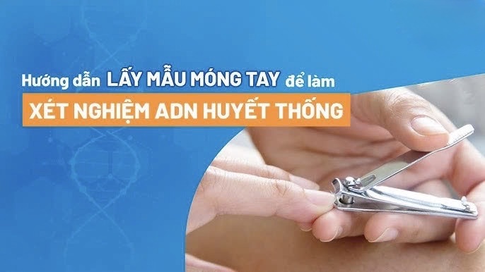 Hướng dẫn cách thu mẫu móng tay