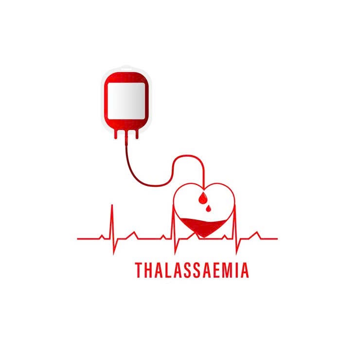 Xét nghiệm Thalassemia, bệnh tan máu bẩm sinh