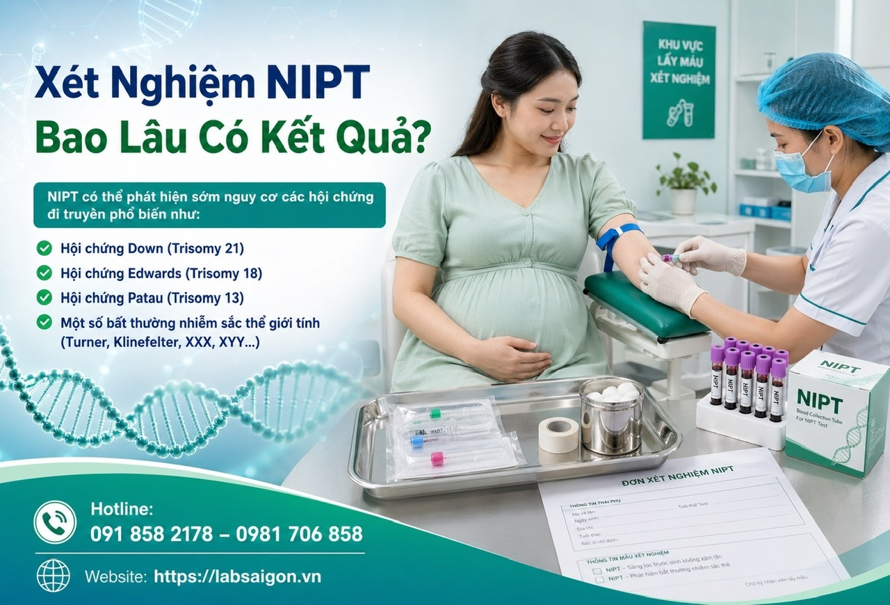 Xét Nghiệm NIPT Bao Lâu Có Kết Quả?