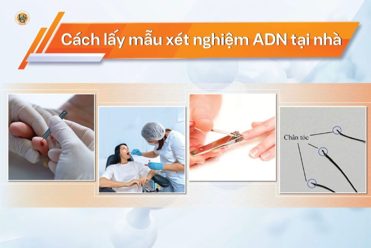 Hướng dẫn lấy mẫu tại nhà làm xét nghiệm ADN