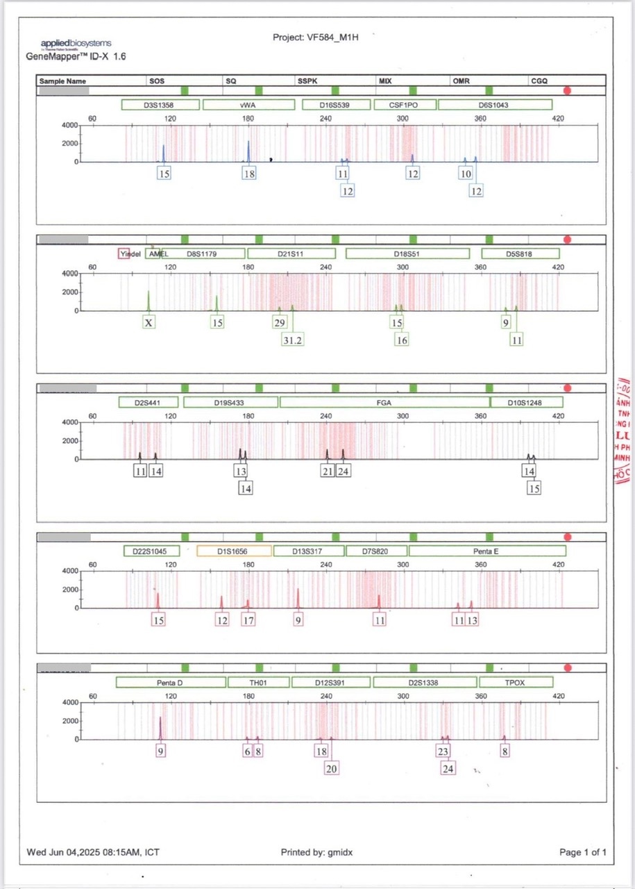 mẫu kết quả xét nghiệm adn pháp lý